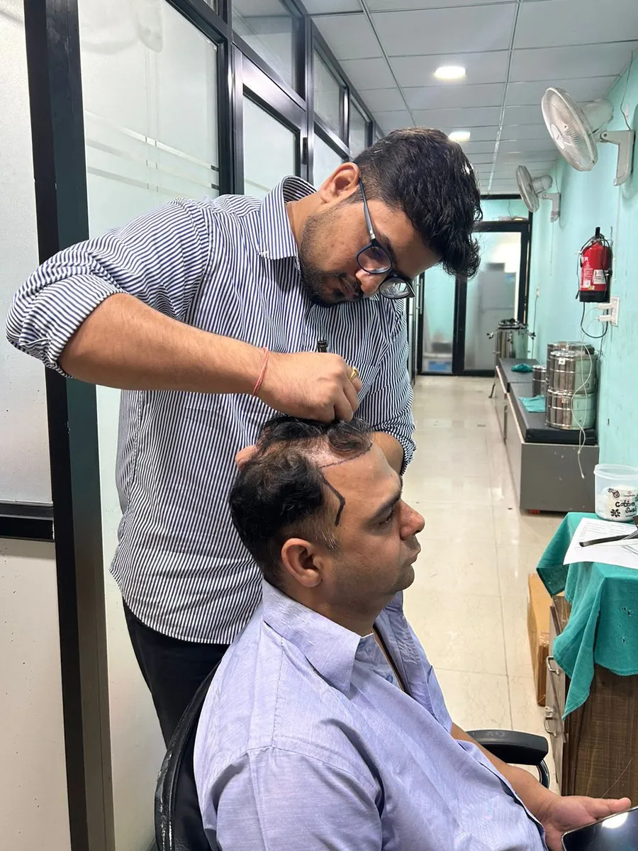 Dr. Atul drawing a new hairline on a patient's forehead