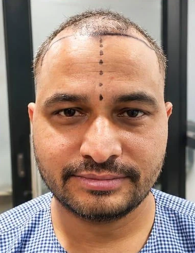 Patient 2 before treatment, front view