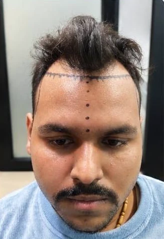 Patient 4 before treatment, front view