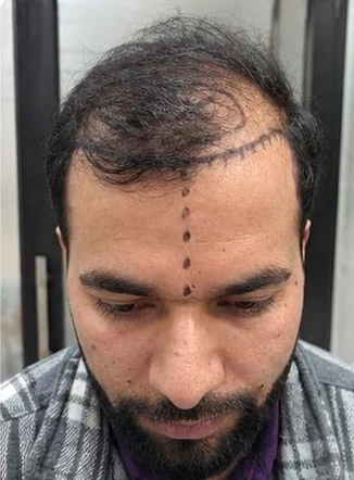 Patient 7 before treatment, front view