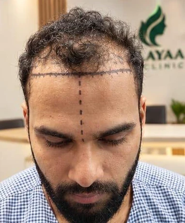 Patient 8 before treatment
