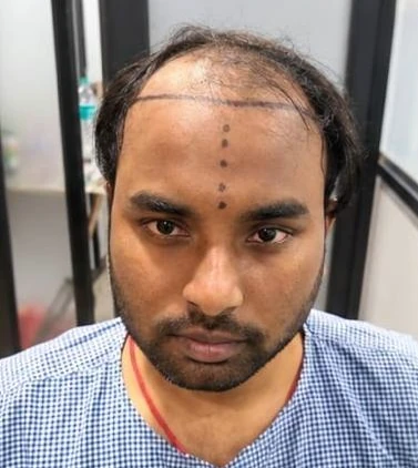 Patient 10 before treatment