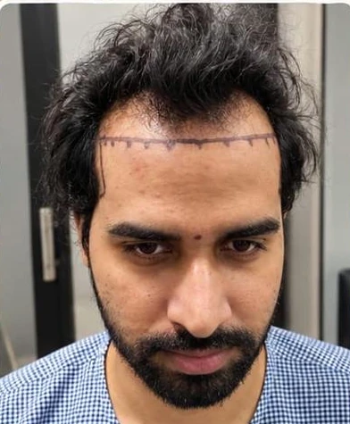 Patient 12 before treatment