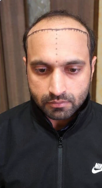 Patient 16 before treatment