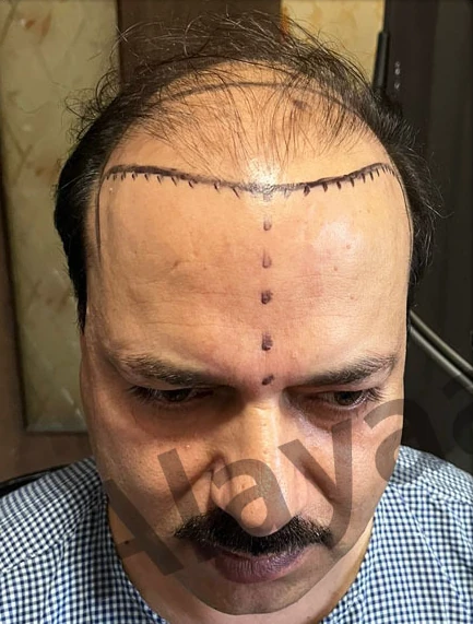 Patient 19 before treatment