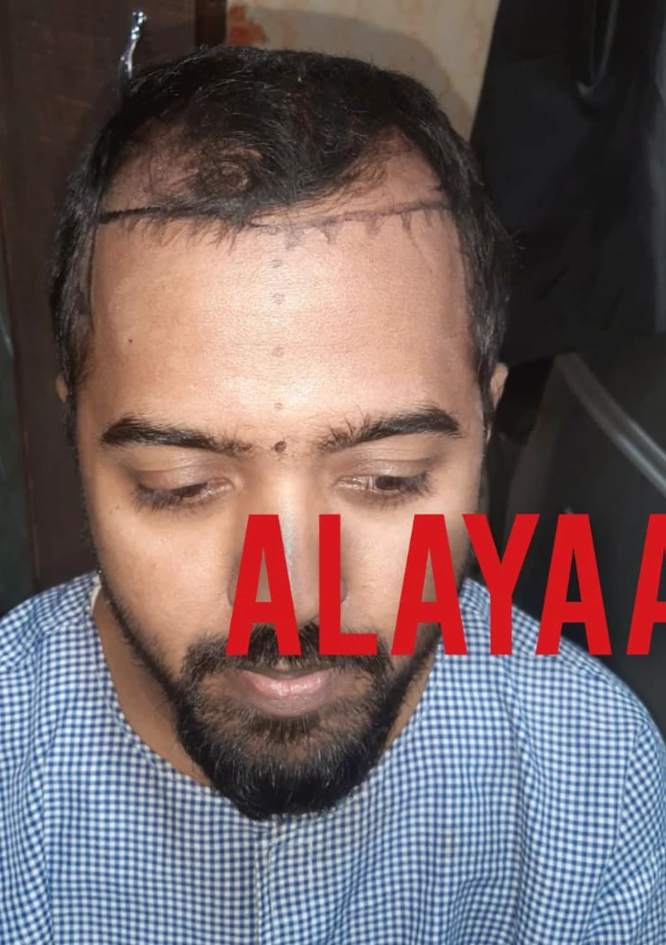 Patient 20 before treatment